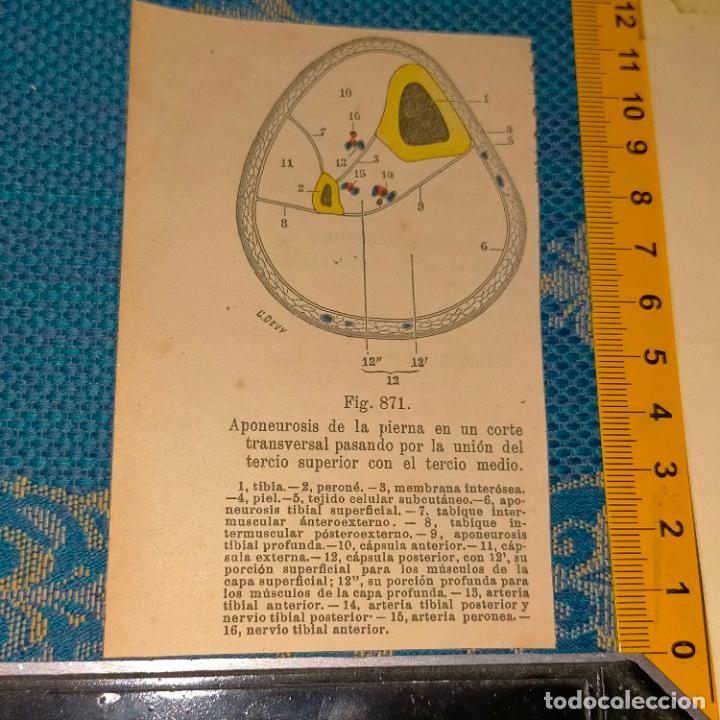 Antiquarische B&uuml;cher: antiguo grabado cuerpo humano medicina a&ntilde;o 1900 medico - PARTES ANATOMIA DISECCION VER FOTOS