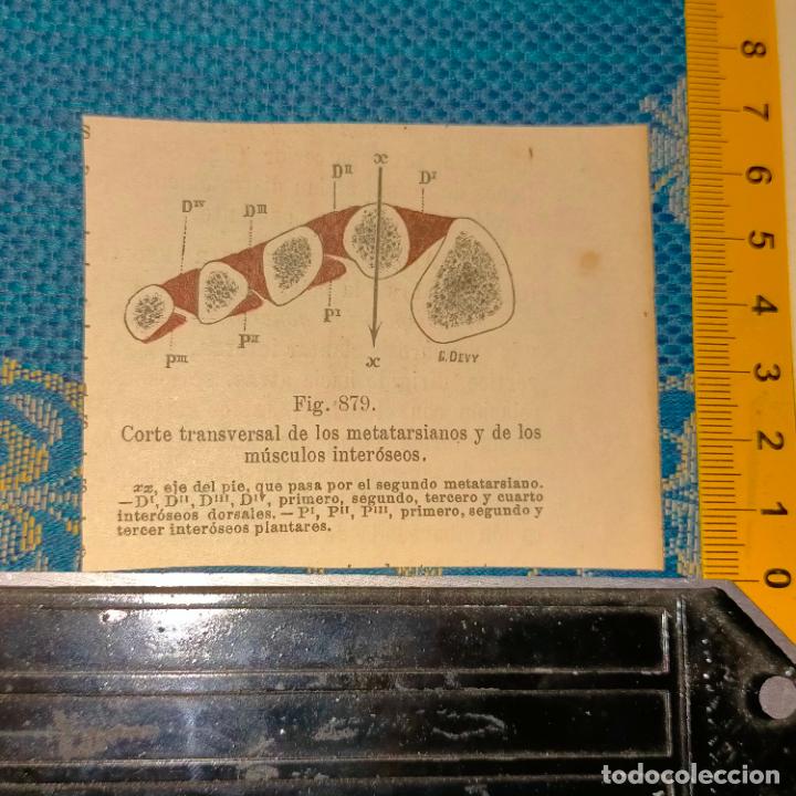 Antiquarische B&uuml;cher: antiguo grabado cuerpo humano medicina a&ntilde;o 1900 medico - PARTES ANATOMIA DISECCION VER FOTOS