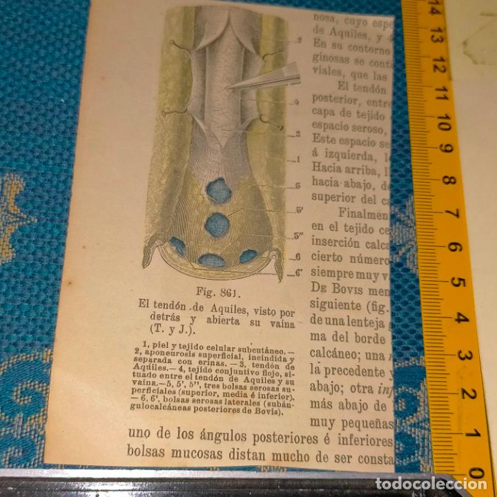 Antiquarische B&uuml;cher: antiguo grabado cuerpo humano medicina a&ntilde;o 1900 medico - PARTES ANATOMIA DISECCION VER FOTOS