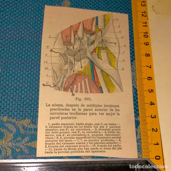 Antiquarische B&uuml;cher: antiguo grabado cuerpo humano medicina a&ntilde;o 1900 medico - PARTES ANATOMIA DISECCION VER FOTOS