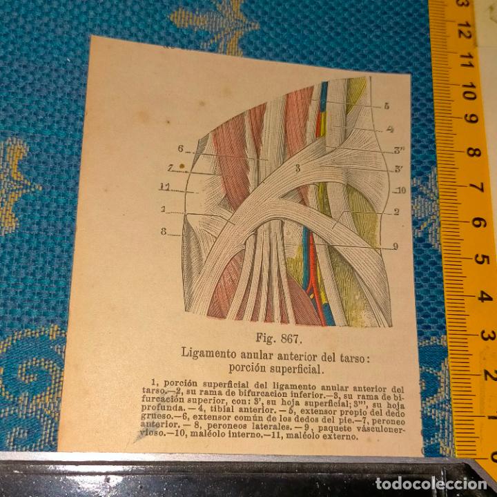 Antiquarische B&uuml;cher: antiguo grabado cuerpo humano medicina a&ntilde;o 1900 medico - PARTES ANATOMIA DISECCION VER FOTOS