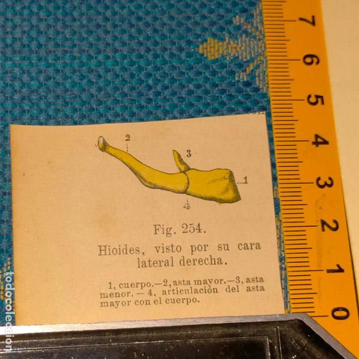 Antiquarische B&uuml;cher: antiguo grabado cuerpo humano medicina a&ntilde;o 1900 medico - PARTES ANATOMIA DISECCION VER FOTOS