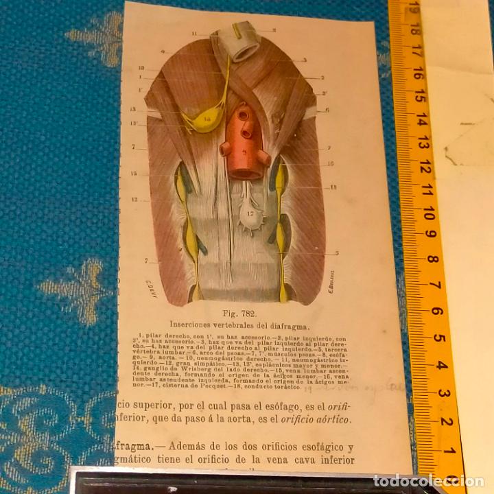 Antiquarische B&uuml;cher: antiguo grabado cuerpo humano medicina a&ntilde;o 1900 medico - PARTES ANATOMIA DISECCION VER FOTOS