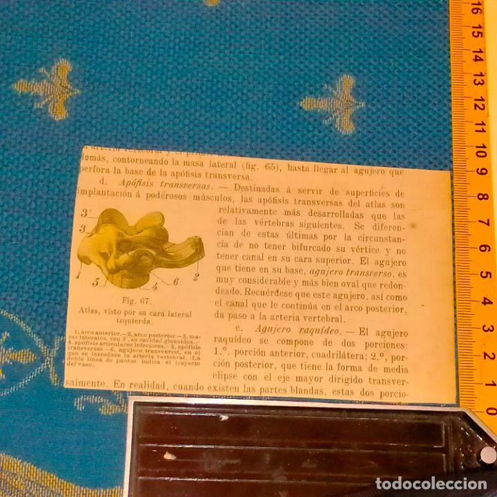 Antiquarische B&uuml;cher: antiguo grabado cuerpo humano medicina a&ntilde;o 1900 medico - PARTES ANATOMIA DISECCION VER FOTOS