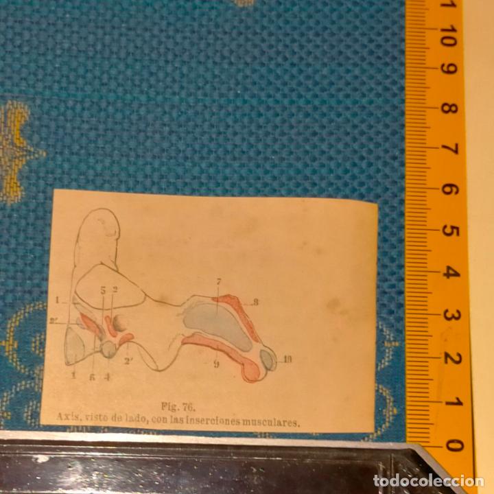 Antiquarische B&uuml;cher: antiguo grabado cuerpo humano medicina a&ntilde;o 1900 medico - PARTES ANATOMIA DISECCION VER FOTOS