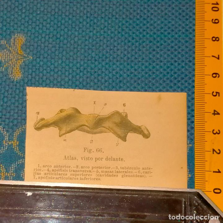 Antiquarische B&uuml;cher: antiguo grabado cuerpo humano medicina a&ntilde;o 1900 medico - PARTES ANATOMIA DISECCION VER FOTOS