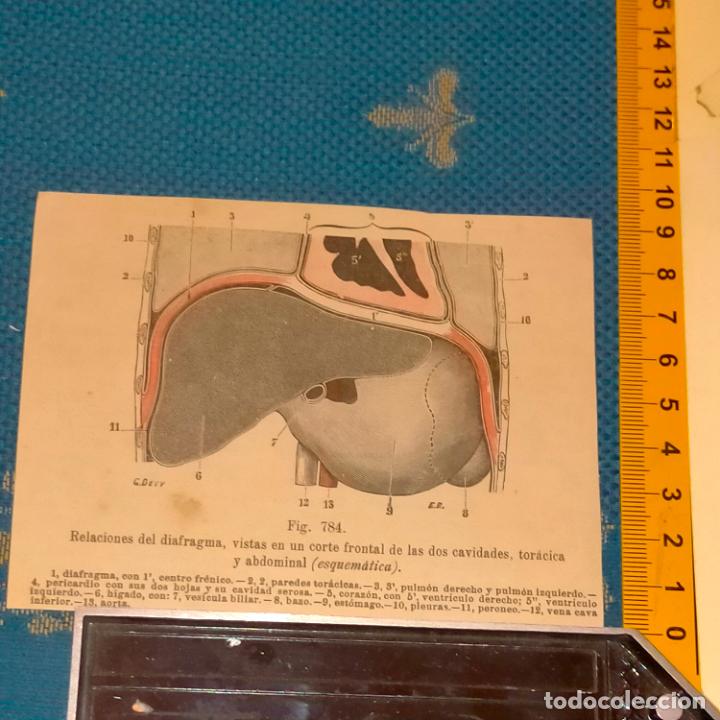 Antiquarische B&uuml;cher: antiguo grabado cuerpo humano medicina a&ntilde;o 1900 medico - PARTES ANATOMIA DISECCION VER FOTOS