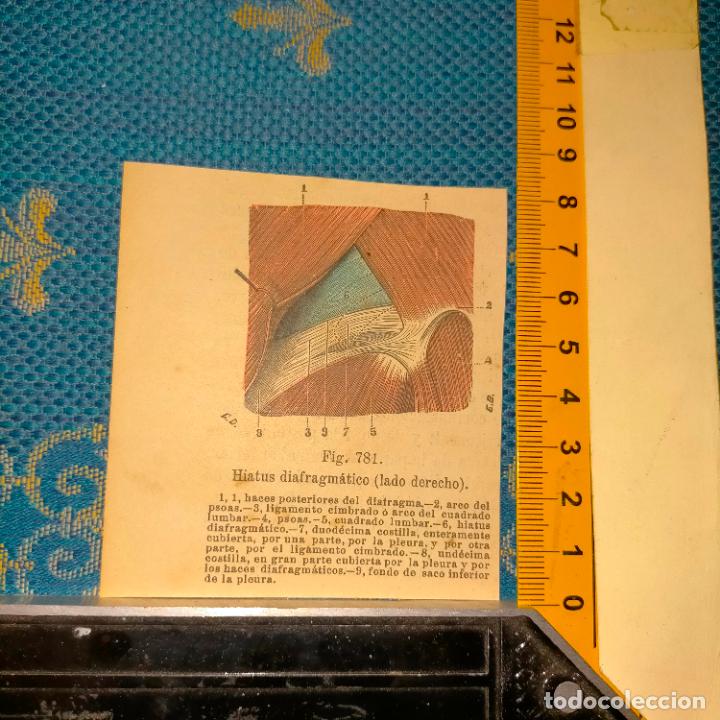 Libri antichi: antiguo grabado cuerpo humano medicina a&ntilde;o 1900 medico - PARTES ANATOMIA DISECCION VER FOTOS