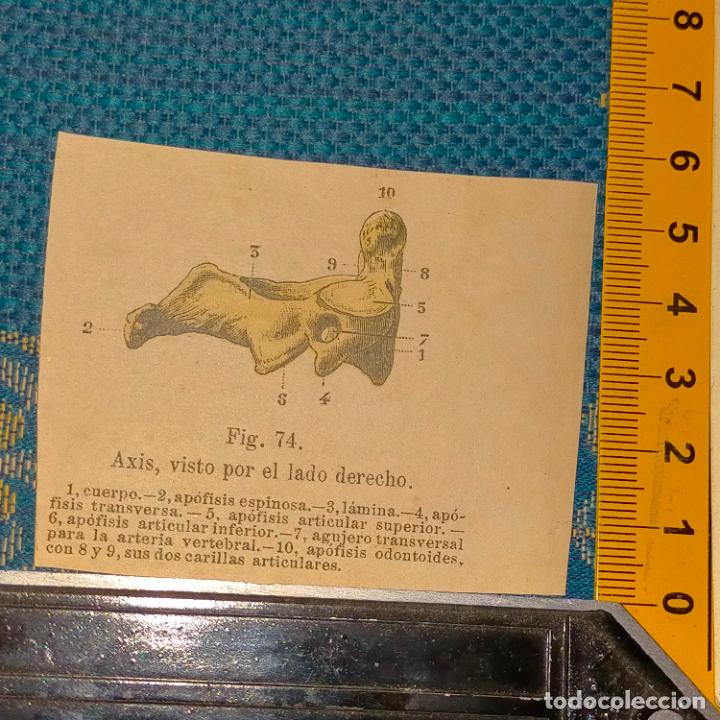 Libri antichi: antiguo grabado cuerpo humano medicina a&ntilde;o 1900 medico - PARTES ANATOMIA DISECCION VER FOTOS