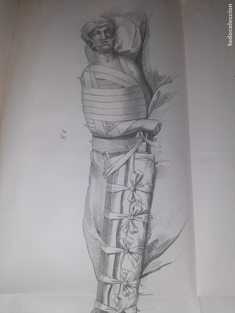 Libros antiguos: Mat&iacute;as NIETO SERRANO. Vendajes. Elementos del arte de los ap&oacute;sitos. Madrid, 1837. L&aacute;minas grabadas.
