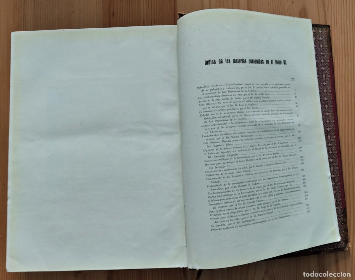 Libros antiguos: LOS PROGRESOS DE LA CL&Iacute;NICA A&Ntilde;O COMPLETO DE 1915 - Foto 6