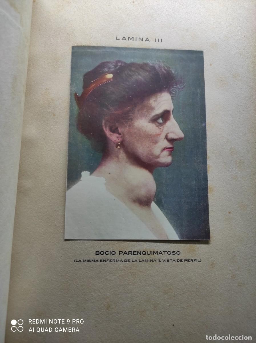 Libros antiguos: LOS PROGRESOS DE LA CL&Iacute;NICA A&Ntilde;O COMPLETO DE 1915 - Foto 8