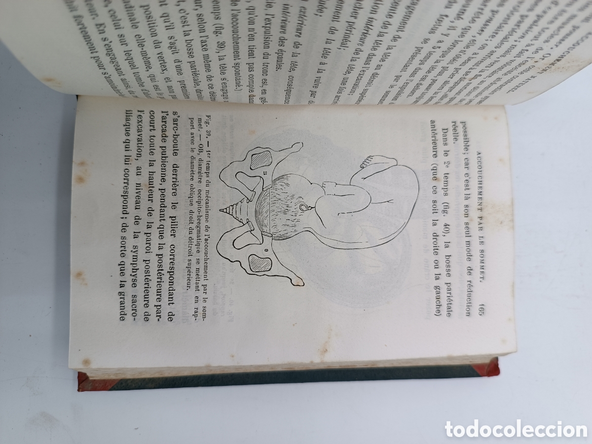 Libros antiguos: Guide practique de laccoucherur 1874 - Foto 4
