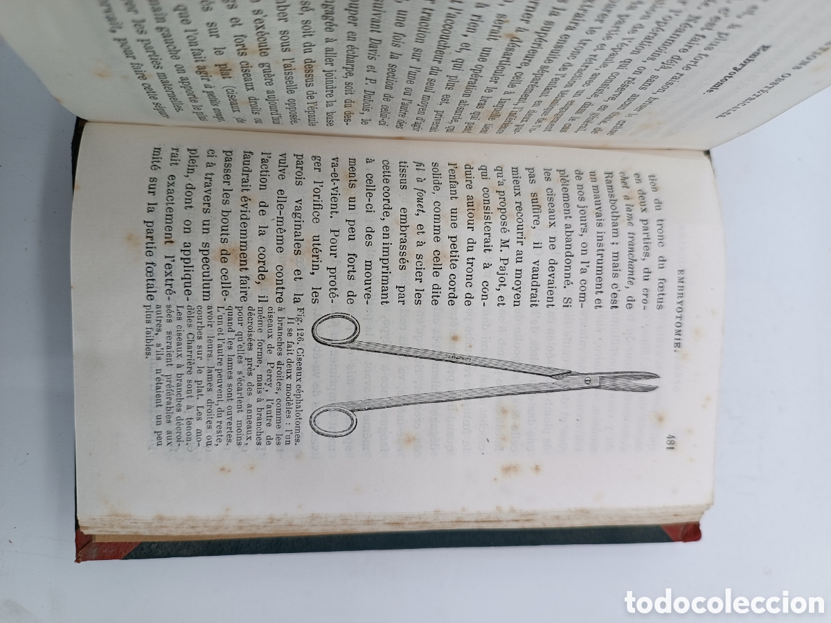 Libros antiguos: Guide practique de laccoucherur 1874 - Foto 7