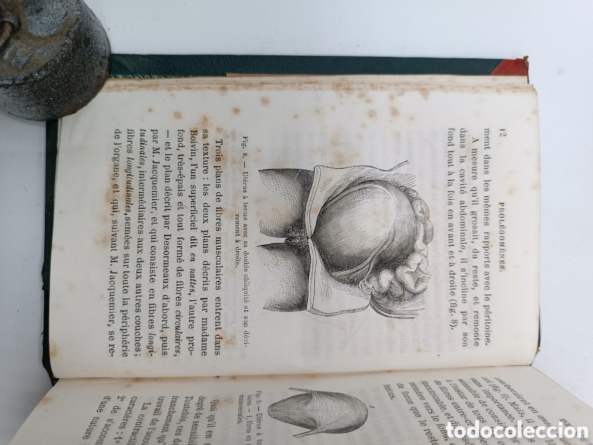 Libros antiguos: Guide practique de laccoucherur 1874 - Foto 8