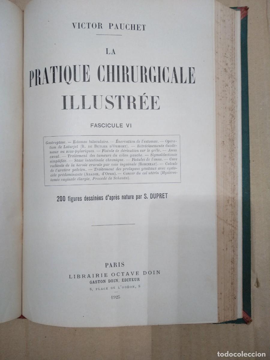 Libros antiguos: PACHET,, LA PRATIQUE CHIRURGICALE ILLUSTRE&Eacute; fasc&iacute;culos VI VII VIII