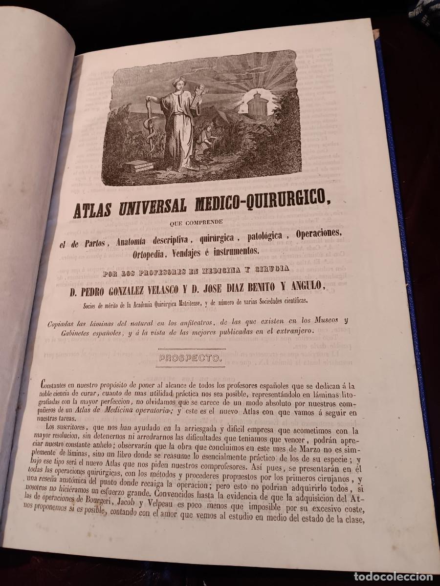 Libros antiguos: PEDRO GONZ&Aacute;LEZ VELASCO Y JOS&Eacute; D&Iacute;AZ BENITO: ATLAS UNIVERSAL M&Eacute;DICO QUIR&Uacute;RGICO. 1854. RAR&Iacute;SIMO