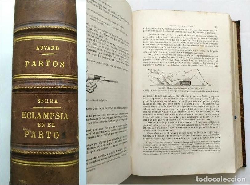 Old books: Tratado pr&aacute;ctico de partos. Auvard. Estudio cl&iacute;nico de la eclampsia en el parto. Serra. Barcelona