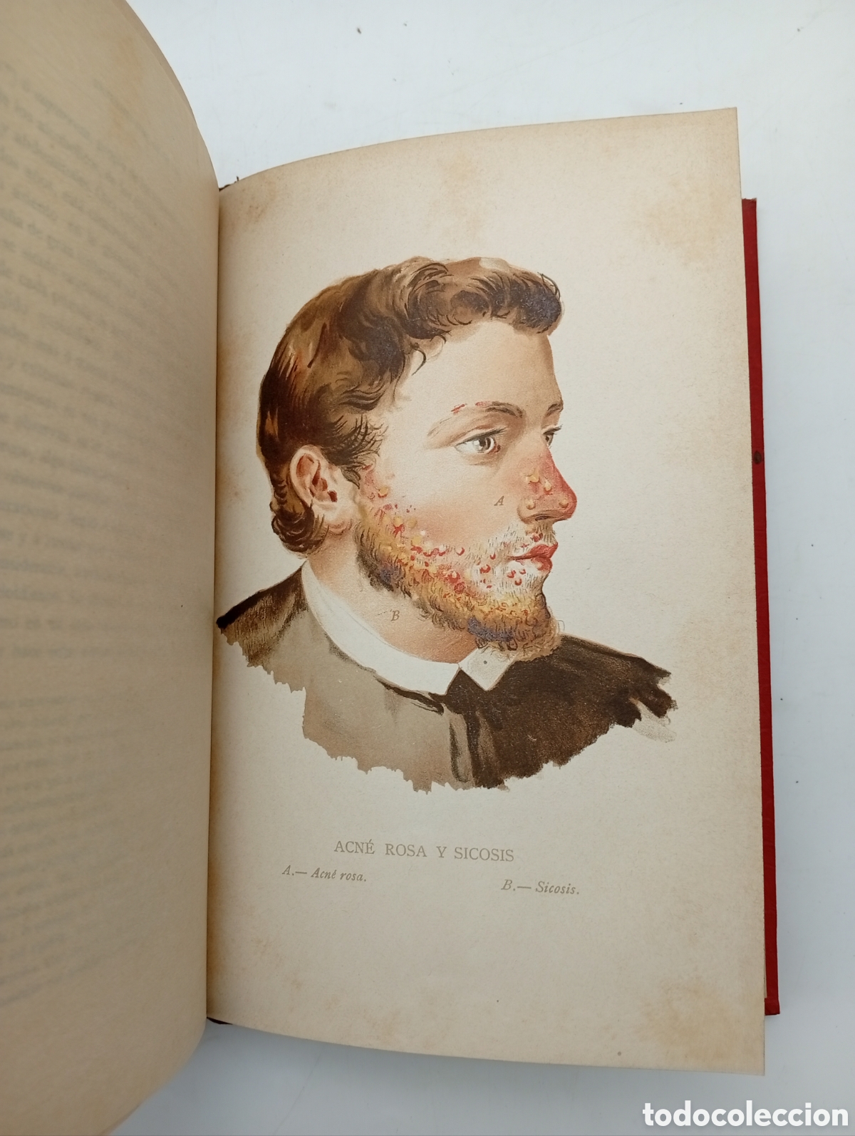 Libros antiguos: Enfermedades de la piel 1900 con ilustraciones