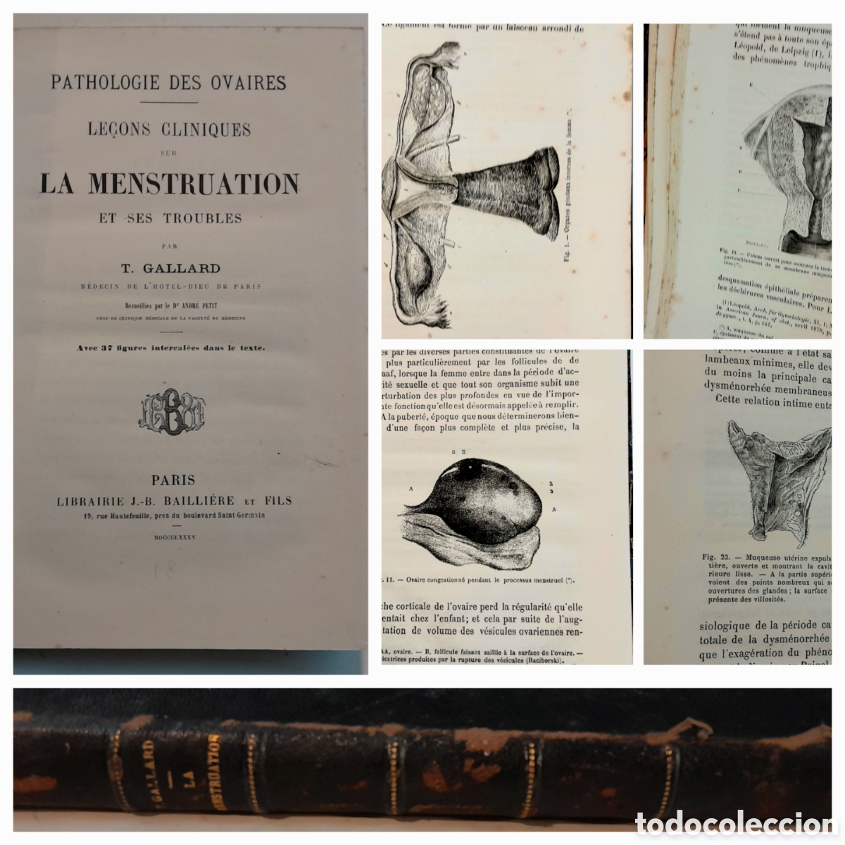 Libros antiguos: LA MENSTRUATION et ses troubles, le&ccedil;ons cliniques. T. Gallard. 1885 ilustrado MENSTRUACI&Oacute;N