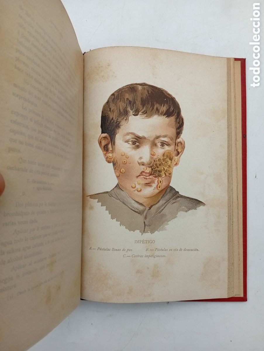 Livres anciens: Enfermedades de la piel 1900 con ilustraciones