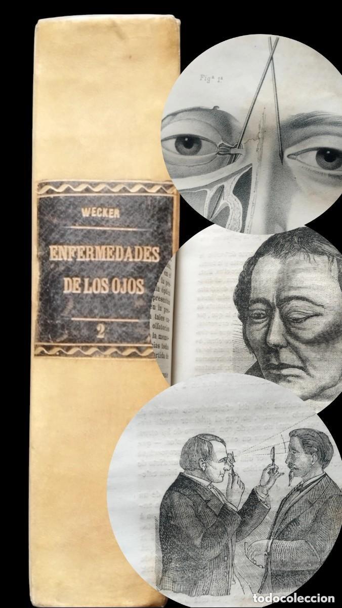 Libros antiguos: TRAT.TEORICO Y PRACTICO ENFERMEDADES DE LOS OJOS. L. WECKER. TOMO SEGUNDO BAILLY-BAILLIERE. 1870