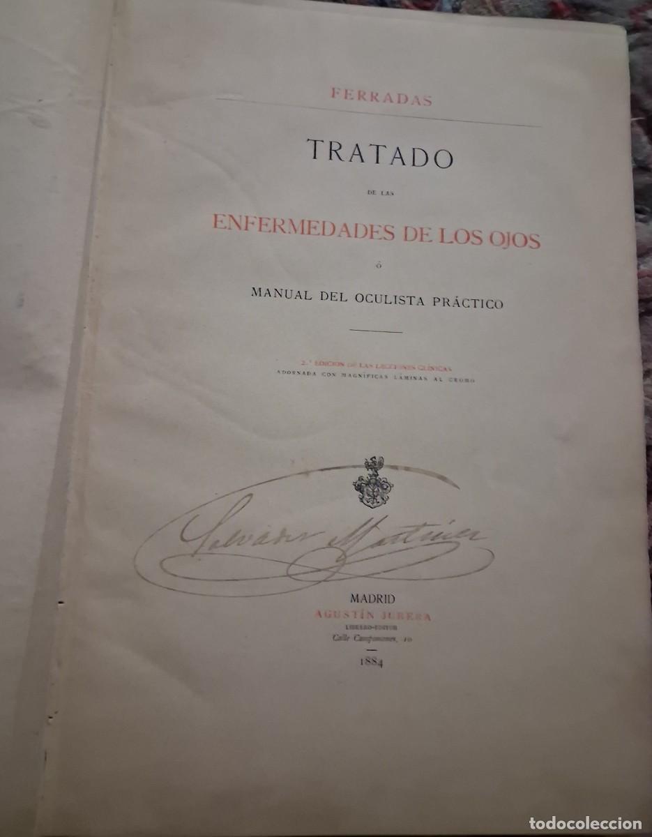 Libros antiguos: Jose Ferradas Tratado de las enfermedades de los ojos 2a ed 1884