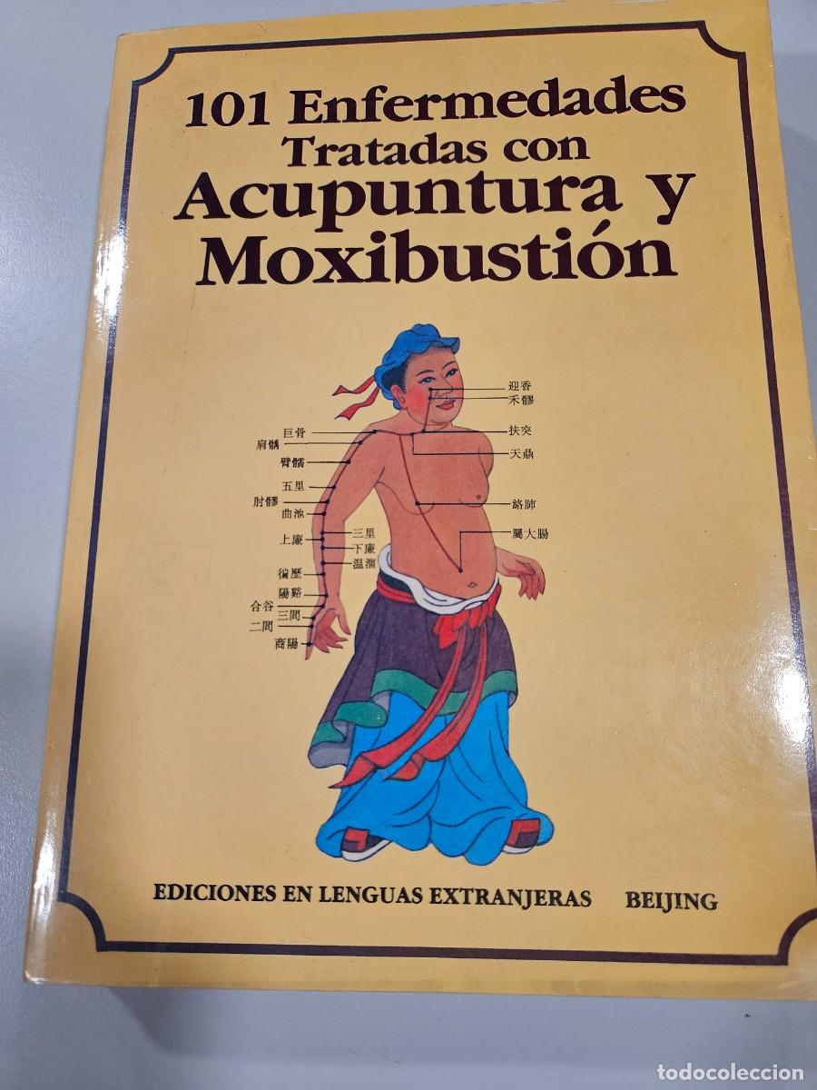 Livres anciens: 101 ENFERMEDADES TRATADAS CON ACUPUNTURA Y MOXIBUSTION