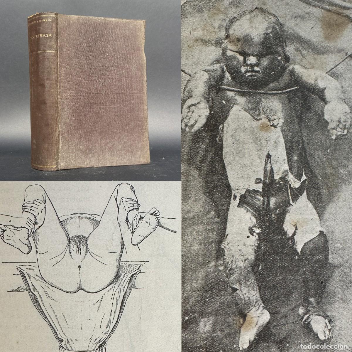 Antiquarische B&uuml;cher: a&ntilde;o 1930 - MANUAL DE OBSTETRICIA - MEDICINA - ILUSTRACIONES - 336 grabados