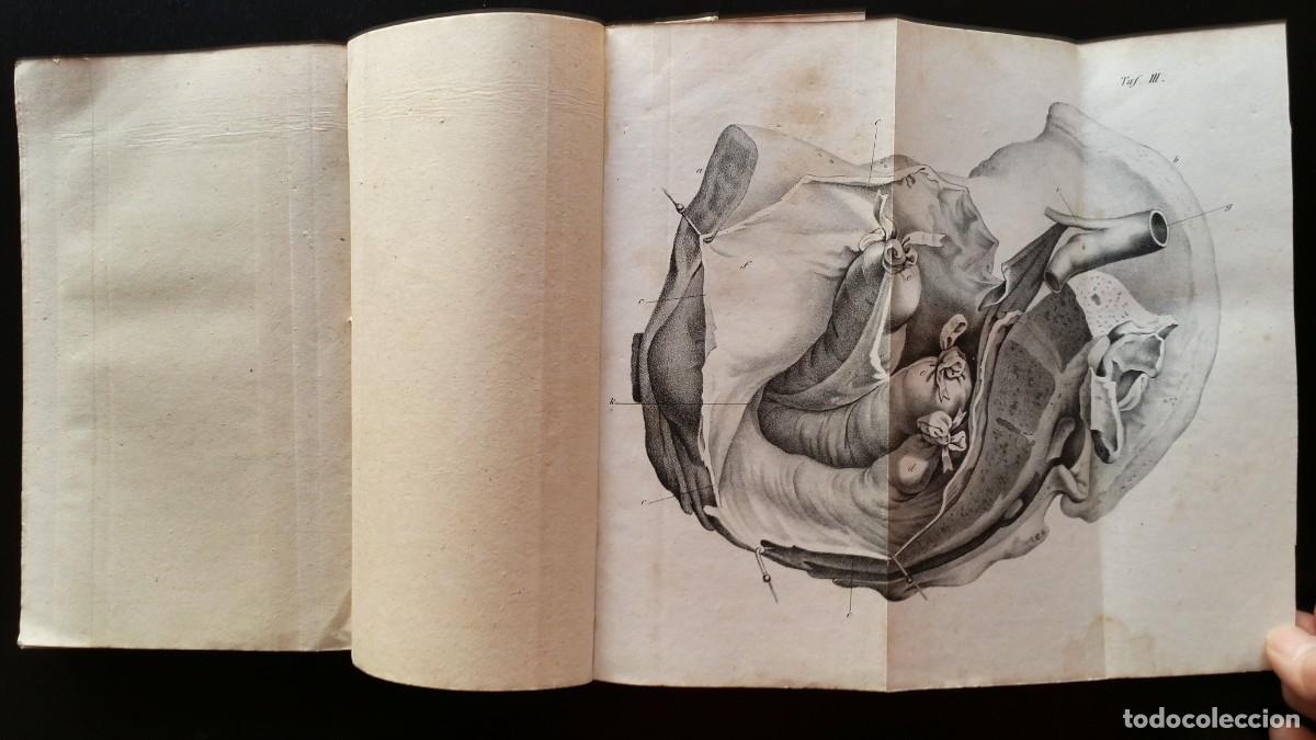 Libros antiguos: Anton SCARPA: Escritos quir&uacute;rgicos / 1831 / extraordinarias litograf&iacute;as en el anexo / muy raro