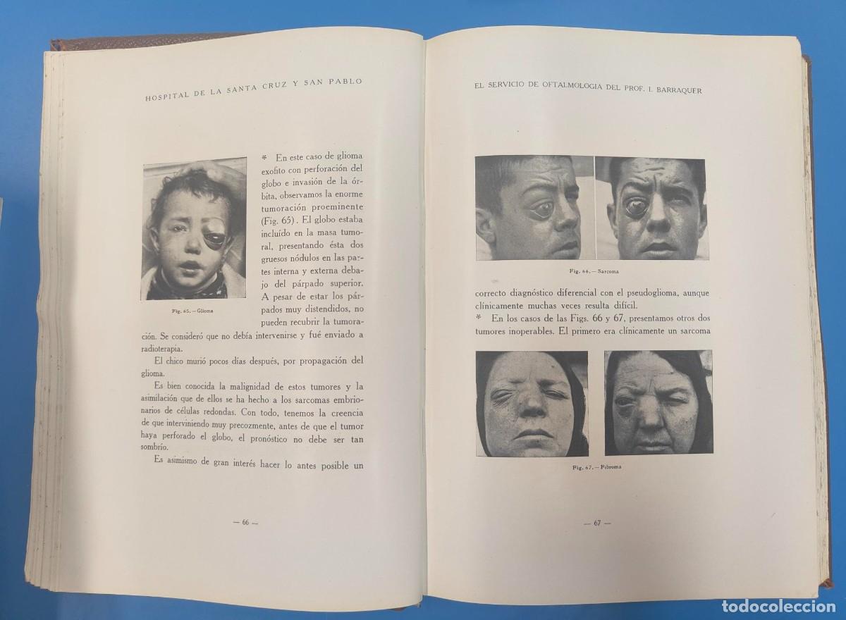 Libros antiguos: EL SERVICIO DE OFTALMOLOGIA DEL PROFESOR I. BARRAQUER ILUSTRADO / CURSOS 1930