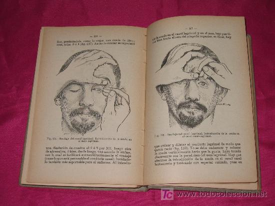 Libros antiguos: ATLAS MANUAL DE LAS OPERACIONES OFTALMOL&Oacute;GICAS - Foto 5