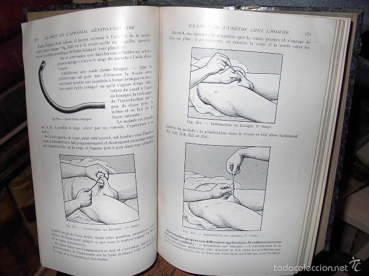 Libros antiguos: DIAGNOSTIC CLINIQUE-A&Ntilde;O 1920 - Foto 3