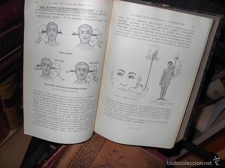 Libros antiguos: DIAGNOSTIC CLINIQUE-A&Ntilde;O 1920 - Foto 4