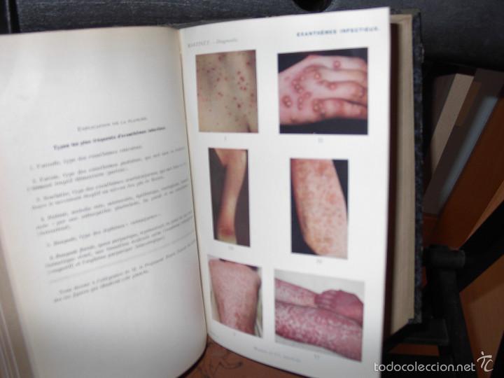 Libros antiguos: DIAGNOSTIC CLINIQUE-A&Ntilde;O 1920 - Foto 5