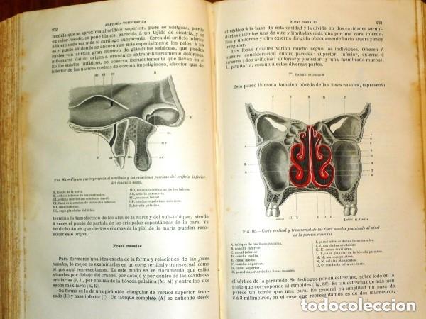 Livros antigos: ANATOM&Iacute;A TOPOGR&Aacute;FICA APLICADA A LA CIRUG&Iacute;A. 1885 (CON 456 Grabados)