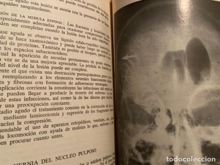 Libros antiguos: McDonald & Chusid. Compendio de Neuro-Anatom&iacute;a y neurolog&iacute;a funcional - Foto 13