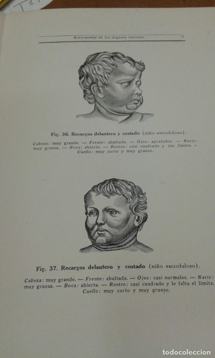 Libros antiguos: EXPRESION DEL ROSTRO LOUIS KUHNE - Foto 4