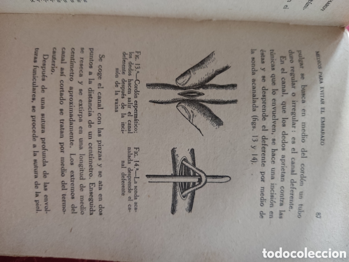 Libros antiguos: Medios para evitar el embarazo a&ntilde;o 1932 - Foto 5
