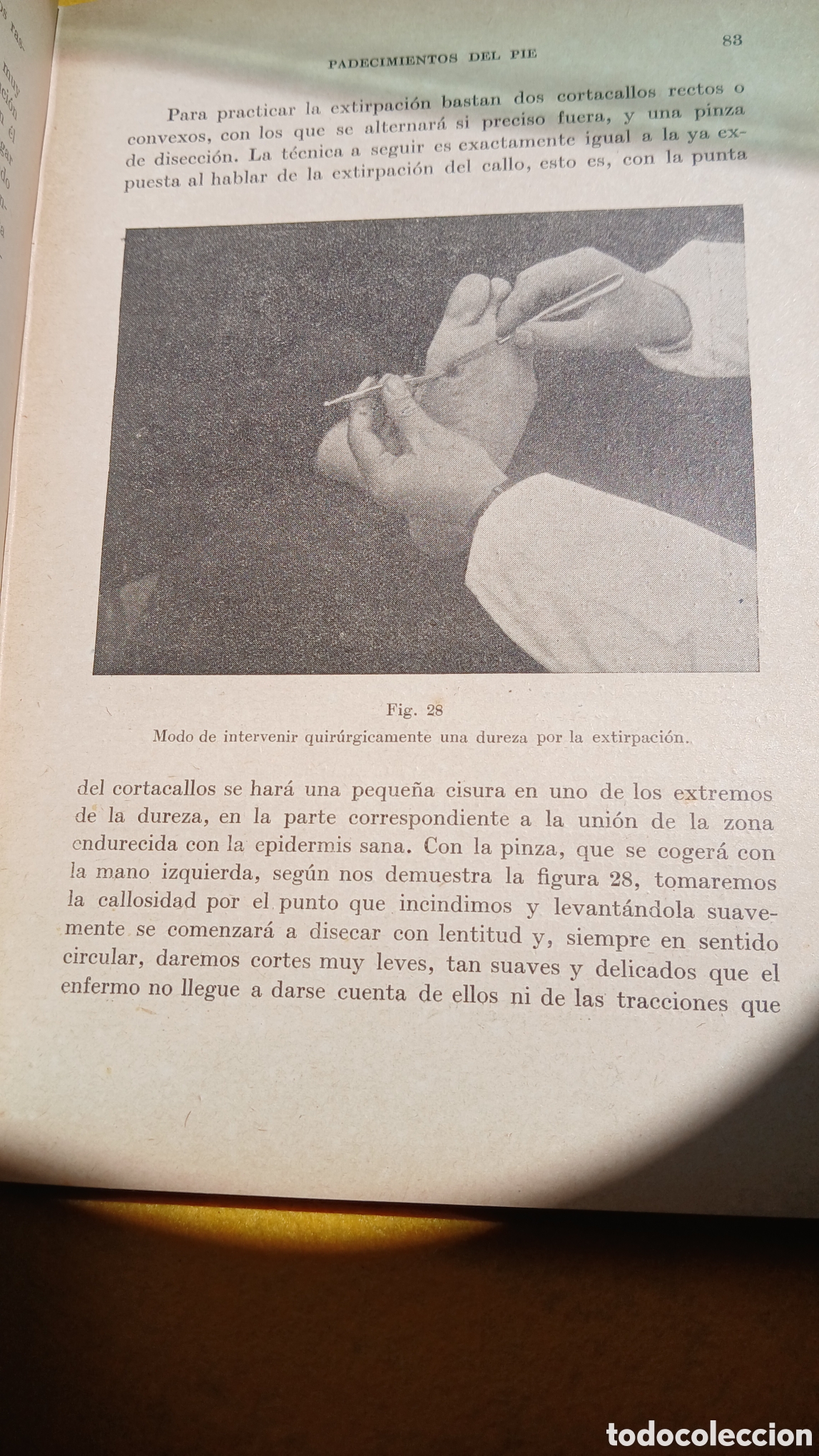 Libros antiguos: Mal de los Pies, Alamilla - Foto 3