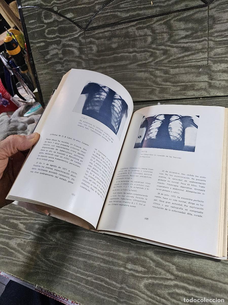 Libros antiguos: libro de venza su enfermedad - Foto 7