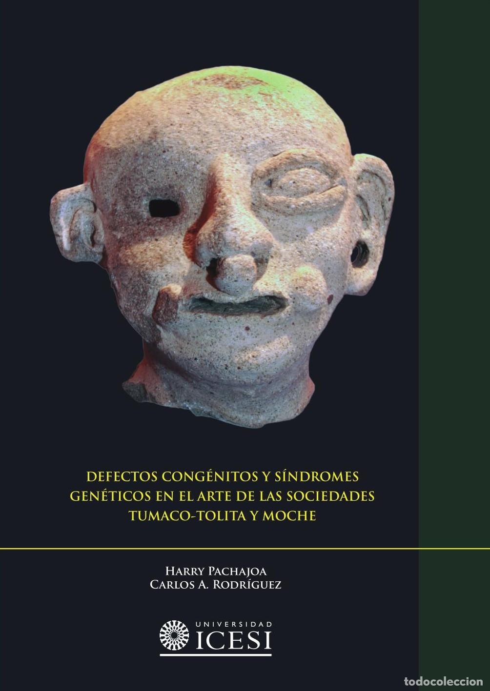 B&uuml;cher: Defectos cong&eacute;nitos y s&iacute;ndromes gen&eacute;ticos en el arte de las sociedades Tumaco-Tolita y Moche - Harry