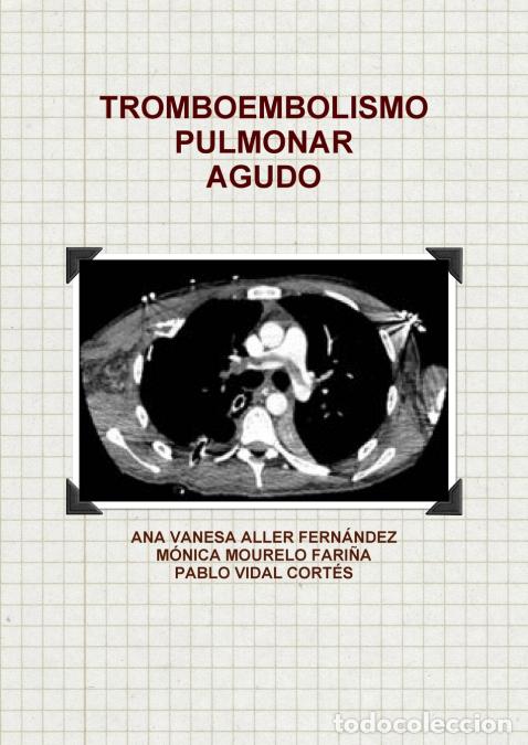 books: TROMBOEMBOLISMO PULMONAR AGUDO - ANA VANESA ALLER FERN&Aacute;NDEZ,PABLO VIDAL CORT&Eacute;S,M&Oacute;NICA MOURELO FARI&Ntilde;A
