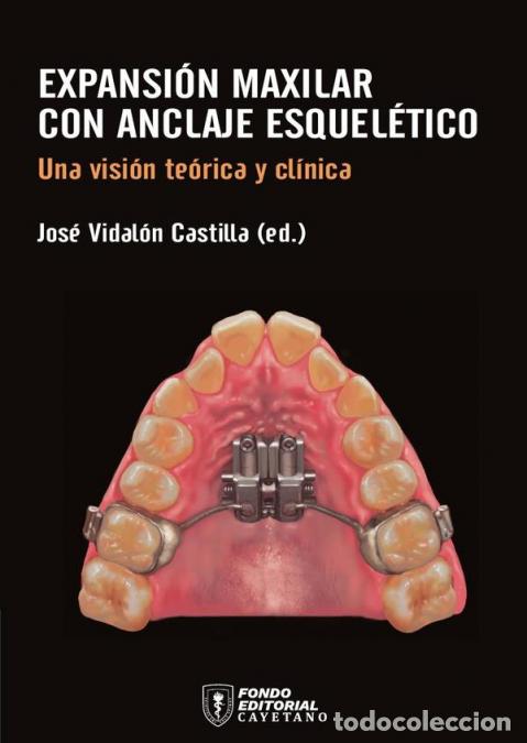 B&uuml;cher: Expansi&oacute;n maxilar con anclaje esquel&eacute;tico - Una visi&oacute;n te&oacute;rica y cl&iacute;nica - Jos&eacute; Antonio Vidal&oacute;n Cas
