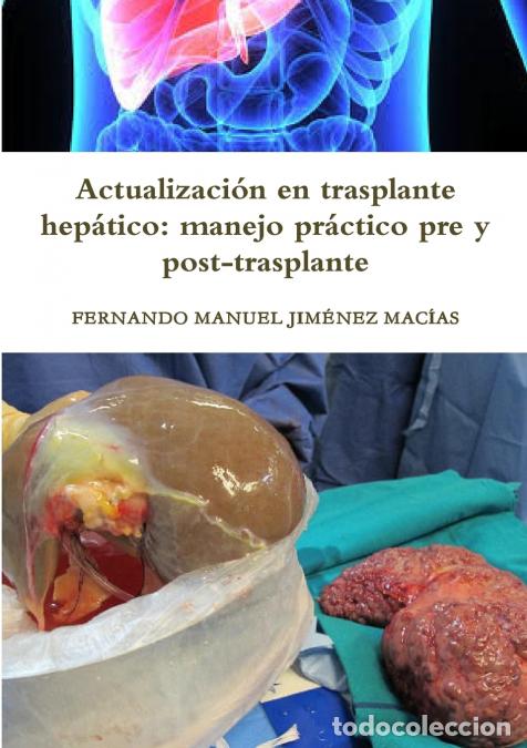 Libri: Actualizaci&oacute;n en trasplante hep&aacute;tico - manejo pr&aacute;ctico pre y post-trasplante - FERNANDO MANUEL JIM&Eacute;N