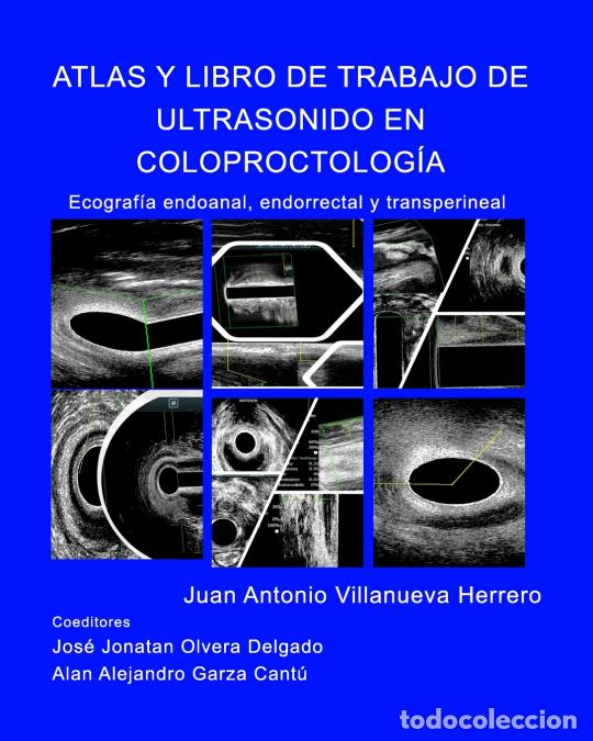 B&uuml;cher: Atlas y Libro de Trabajo de Ultrasonido en Coloproctolog&iacute;a - Ecografia endoanal, endorrectal y trans