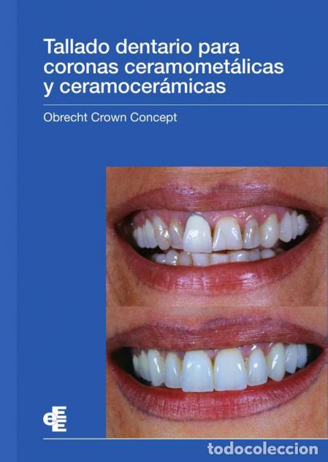 books: Tallado dentario para coronas ceramomet&aacute;licas y ceramocer&aacute;micas - Obrecht Crown Concept - Marc Obrec