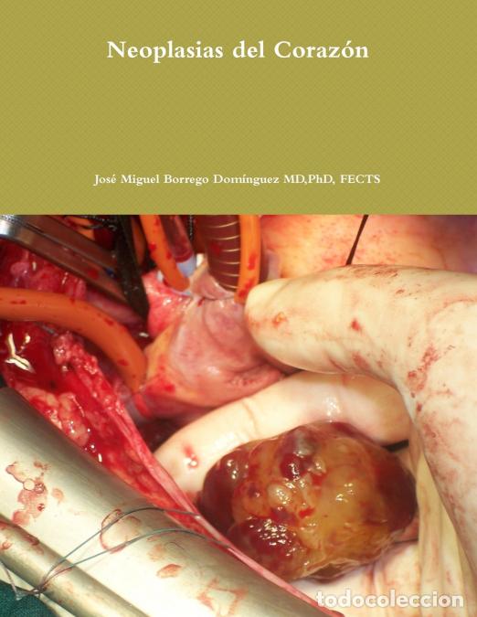 B&uuml;cher: Neoplasias del Coraz&oacute;n - Jos&eacute; Miguel Borrego Dom&iacute;nguez