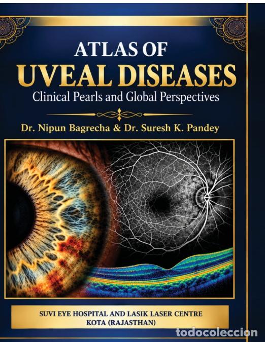 Libri: ATLAS OF UVEAL DISEASES - Clinical Pearls and Global Perspectives - DR.NIPUN BAGRECHA