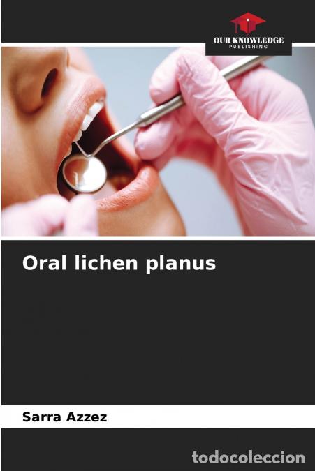 Livros: Oral lichen planus - Sarra Azzez